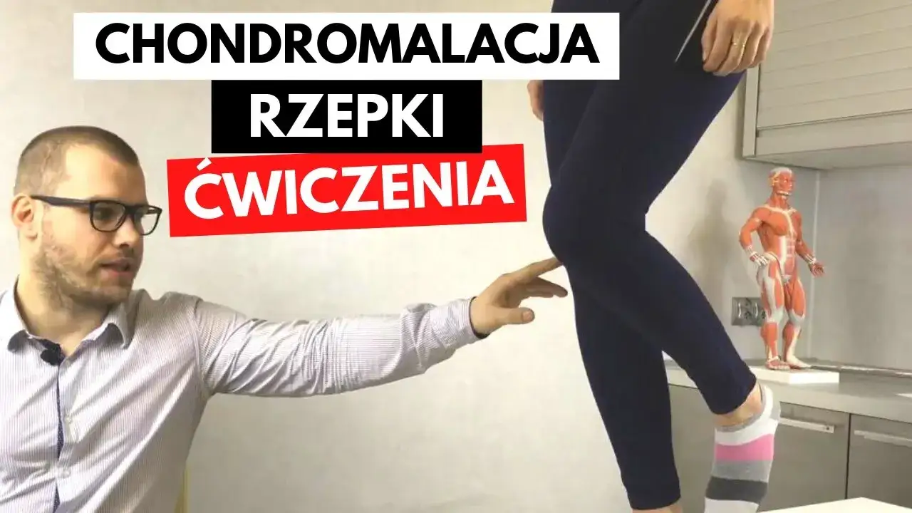 Chondromalacja rzepki ćwiczenia zakazane przykłady