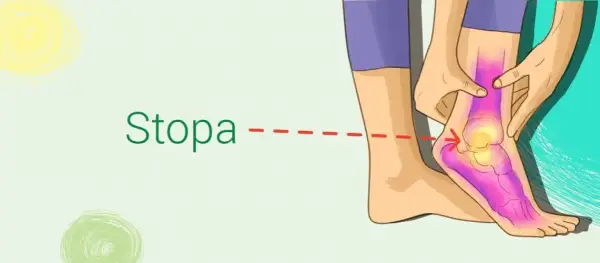 Ból śródstopia u biegaczy: Jak skutecznie leczyć i zapobiegać?